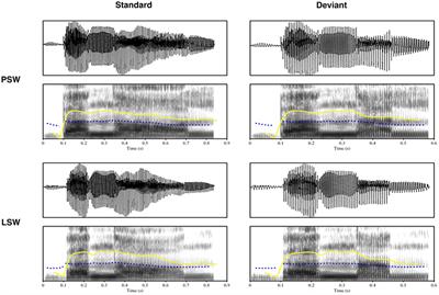 Lexical Specification of Prosodic Information in Swedish: Evidence from Mismatch Negativity